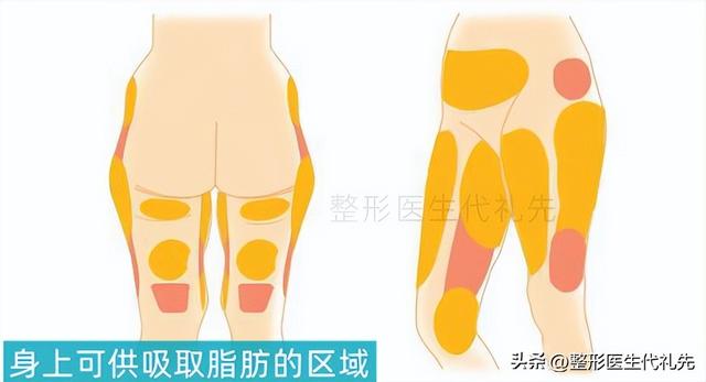 脂肪胶是什么材料 2026年脂肪胶是什么材料制成的