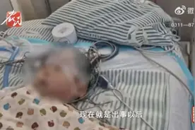 太粗心！因家长疏忽，1岁男童摔倒2个月后突然重度昏迷、离奇病危图片