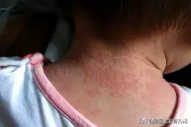 “吹空调”和“吹风扇”的孩子，不用一个夏天，身体差距就很明显图片