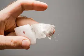 手指被502胶水粘住不用怕，教您4招，只需滴一滴，胶水自动融化图片