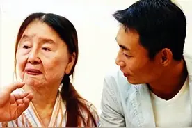 03年17岁少女一夜变怪物老太，儿子不敢相认，切皮三次后判若两人图片