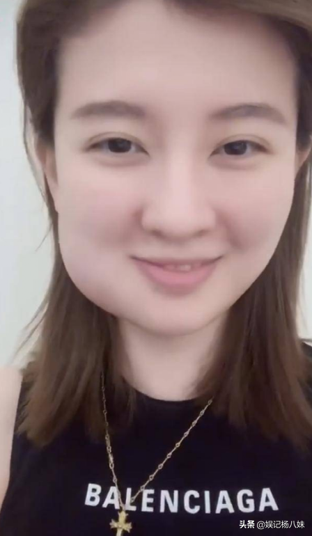 有种"毁容"叫拔智齿,周冬雨圆润发肿,看到黄晓明我忍不住笑了