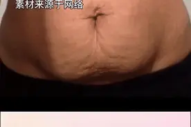 竖剖刀口篇：刀口赘肉减不掉怎么办？图片