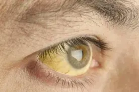 这8个症状可能是肝癌的信号，一定要警惕图片