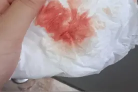 熬夜咳出血，大家有过这样子吗图片