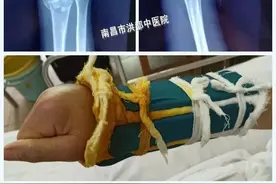 雪道尽头是骨科？骨科专家教您如何避免滑雪受伤图片