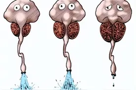 两种情况的前列腺增生，一般药物很难改善，需要微创干预！图片