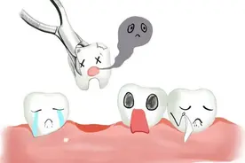 镶牙前牙根的处理：“把根留住”？还是不留？图片