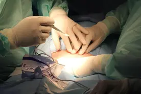 手术切除的人体组织都去哪了？图片