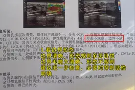 乳腺B超单上的描述看不懂？别急，我来教你图片
