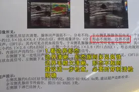 乳腺B超单上的描述看不懂？别急，我来教你图片