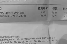 妻子喉咙长“菜花”丈夫无幸免感染HPV 医生：不良习惯要改掉图片