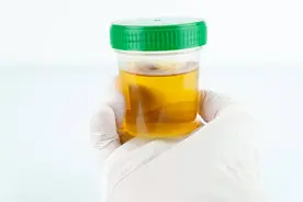 尿液出现不同异味，或是4类健康问题征兆，别不当回事图片