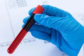 新要求：糖化过了这个线，血糖不高也要吃药图片