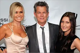 维密超模表面光鲜？贝拉自曝14岁时隆鼻，被抑郁症困扰多年太痛苦图片