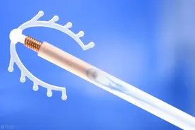女性上环的全过程，过程让人胆寒，别害羞，男女都该好好看看！图片