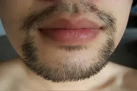 早上刚刮了胡子，隔早就长出来了，胡须长得太快意味着什么？图片