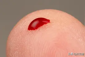 滴血认亲，真的一点用都没有吗？为什么古人都深信不疑？图片