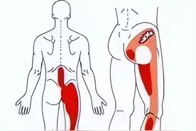 为啥臀部、小腿后外侧酸胀痛、麻木？该如何应对？一文详细告知您图片