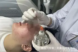 南昌大学二附院系列科普：痘痘来袭，中医特色火针帮助您图片