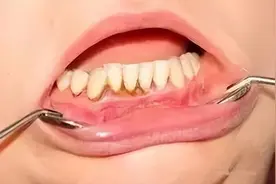 开学了，看看孩子们的牙齿成什么样子了？图片