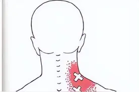 三个动作缓解你的肩胛骨缝疼痛图片