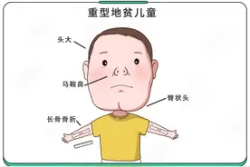 7旬老人为救地贫孙女，顶烈日搬砖！地贫，真要终身治疗吗图片