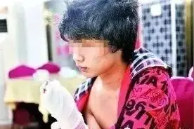 案例回顾：武汉市第三医院一男子钱不够，伤口缝好后被拆线！图片