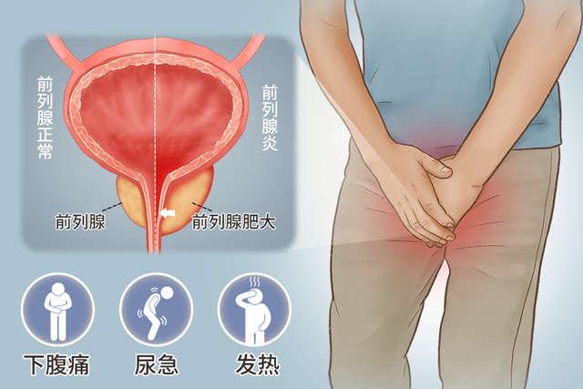 前列腺是男人的生命腺，提醒：4个症状出现，或是前列腺增生信号