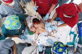 09年，湖北孕妇生下首例“坐骨连体姐妹”，如今她们活成这般模样图片