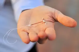 节育环不取出，会长到肉里吗？医生：取环年龄尽量别超过这个岁数图片