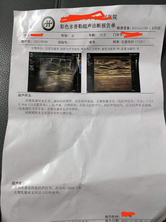 女性都在关注的乳腺BI-RADS分级法，教你自己评估乳腺健康