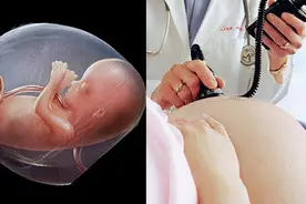 什么是胎芽、胎心？胎心又有什么意义？图片