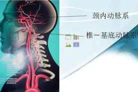 颅脑动脉系统及CTA检查技术，一文读懂图片