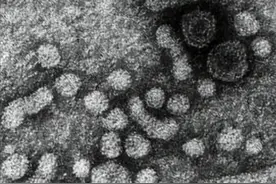 乙肝病毒DNA检测小于100 IU/ml，这种情况需要抗病毒治疗吗？图片