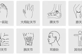 浅谈：痛风各期症状与危害图片