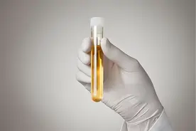 小便后记得看一眼！尿液的这些异常信号，可能是身体在求救图片