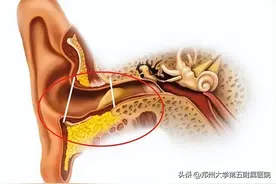 耳朵掏不掏？怎么掏？这些看似简单的问题，你真的思考过吗？图片