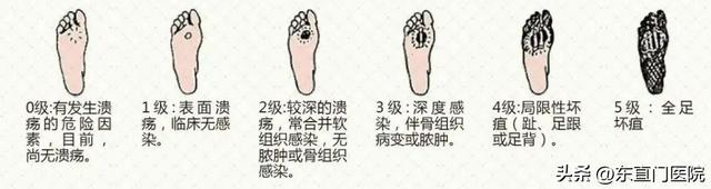 老年糖尿病及其并发症如何防治？这份锦囊为您支招