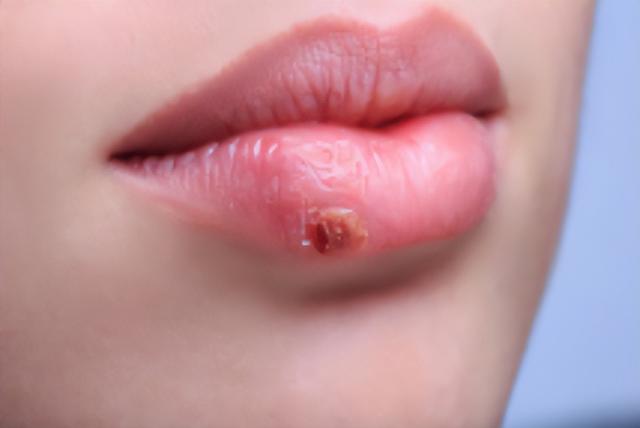 人体8种必需氨基酸的简单记忆法+赖氨酸详解