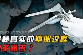 堕胎手术有多可怕？真实堕胎手术的经历，听完令人毛骨悚然图片