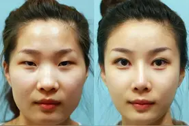 “整容美人”和“自然美人”，老了后差别大？对比看看你就懂了图片