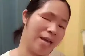 独眼女子不能办残疾证？评残到底有多难？有没有故意刁难？图片