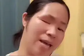 独眼女子不能办残疾证？评残到底有多难？有没有故意刁难？图片