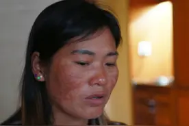 原配被小三划百刀毁容，还被亲生儿女告上法庭，儿子：我爸没错图片