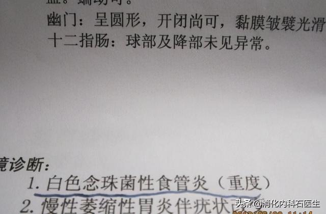 胸前像鸡皮疙瘩似的