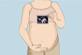 为什么有些女生肚脐下有一条黑竖线？其实很多人都有，不懂别乱说图片