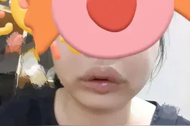 种牙植骨，有多痛！图片