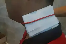 皮肤长“小肉球”是怎么回事，可以抠掉吗？如何处理？一文看懂图片