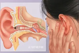 耳鸣种类多样！各类声音的耳鸣都代表什么？图片